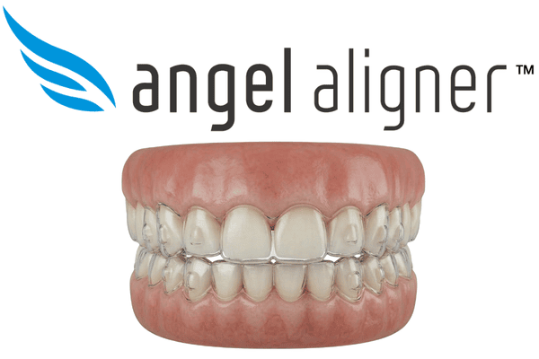 Angel Aligners