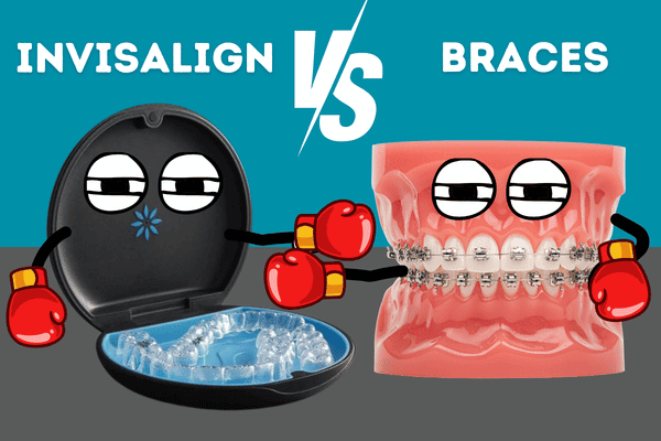 Invisalign vs. Braces