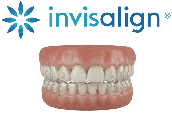 Invisalign