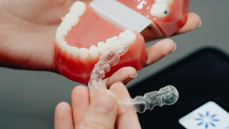 Read more about the article WHY YOU SHOULD GET INVISALIGN FROM AN ORTHODONTIST