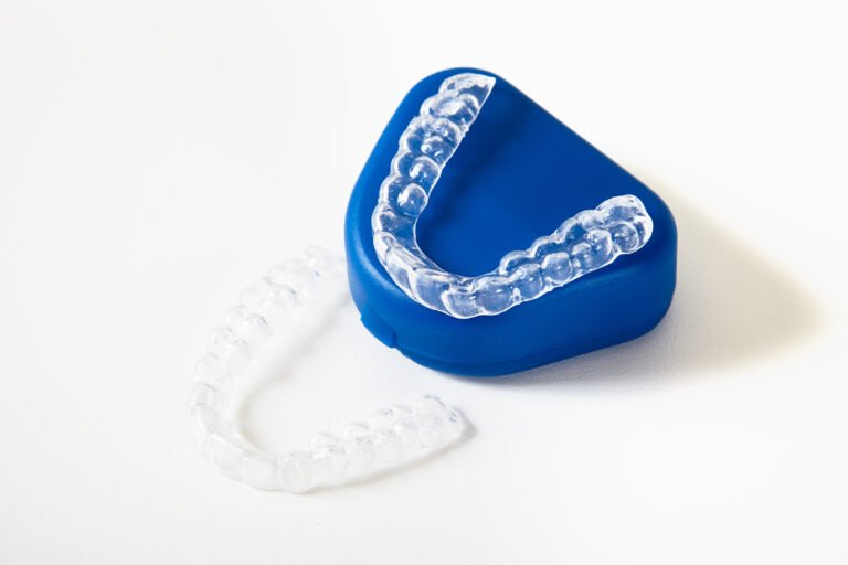 Read more about the article TIPS FOR PROTECTING YOUR RETAINERS